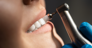 Dental Cleaning - Emergency Dental Of Colorado Springs