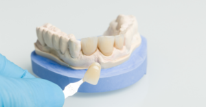 Dental Crowns In Colorado Springs